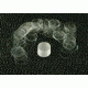 VWR Vwr Coverglass Rnd #1 25mm Oz VWRCIR1-25MM, Unit ONZ